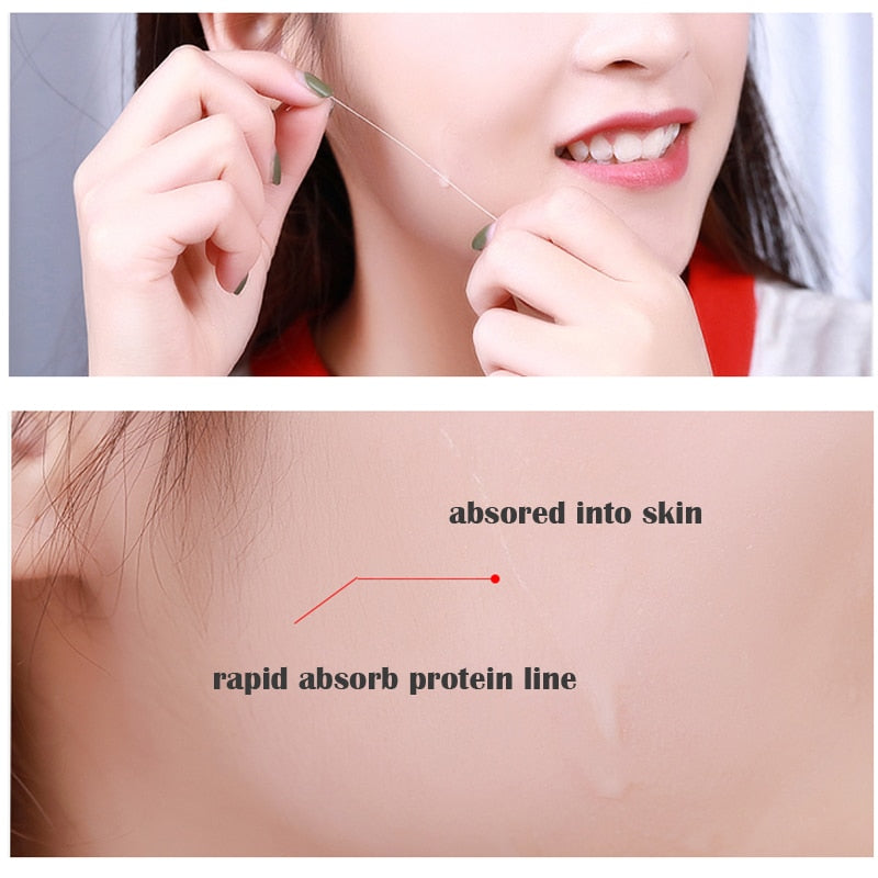 Face Filler Absorbable Collagen Protein Thread Face Lift Plump Silk Fibroin Line Carving Anti Aging Essence