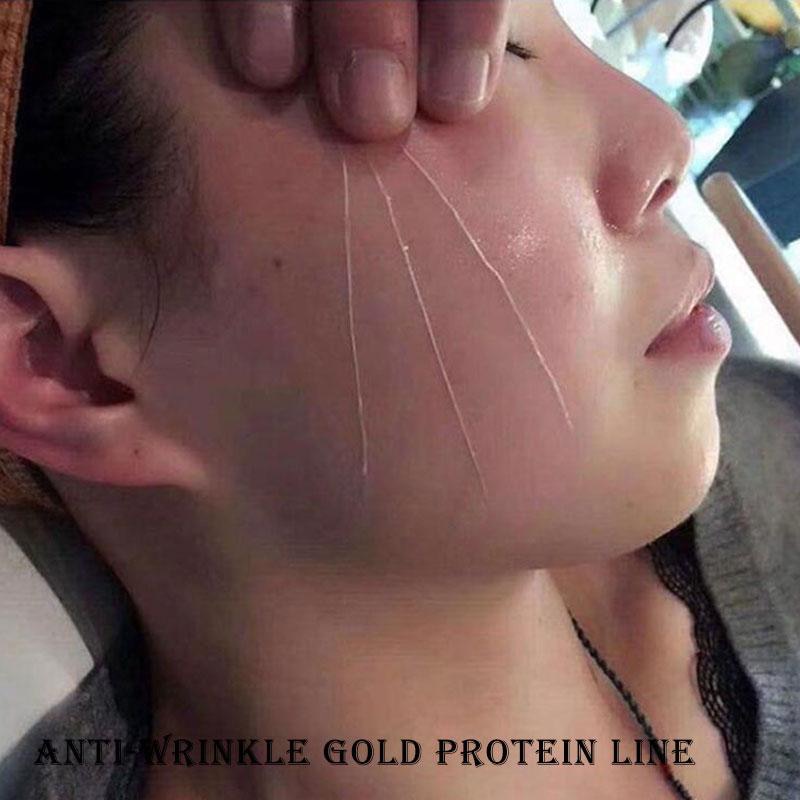 Face Filler Absorbable Collagen Protein Thread Face Lift Plump Silk Fibroin Line Carving Anti Aging Essence